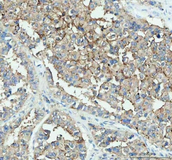 IHC staining of FFPE human liver tissue with DDT antibody. HIER: boil tissue sections in pH8 EDTA for 10-20 min followed by cooling at RT for 20 min.