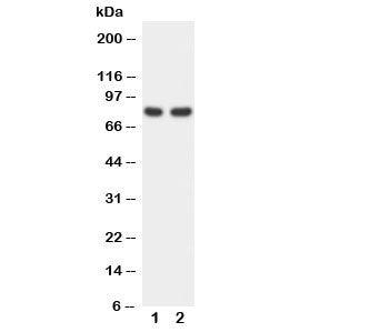 Western blot testing of FOXP1 antibody and Lane 1: rat spleen; 2: COLO320 cell lysate. Predicted/observed molecular weight: ~75 kDa.