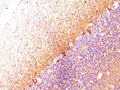 IHC: Formalin-fixed, paraffin-embedded human cerebellum stained with Neurofilament antibody (RT-97 + NR-4).