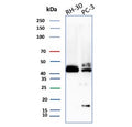 Western blot testing of human RH30 and PC-3 cell lysate with CD83 antibody. Expected molecular weight: ~23-60 kDa depending on level of glycosylation.