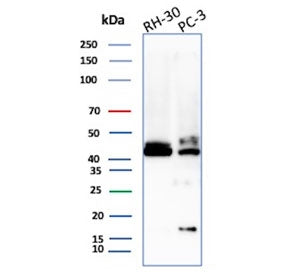 Western blot testing of human RH30 and PC-3 cell lysate with CD83 antibody. Expected molecular weight: ~23-60 kDa depending on level of glycosylation.