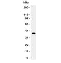 Western blot testing of Cathepsin B antibody and human HepG2 lysate. Molecular weight: 38-46 kDa depending on glycosylation level. An ~31 kDa form (propeptide removed) may be observed and may be further processed into an ~25 kDa heavy chain and ~5 kDa light chain.