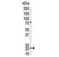 Western blot testing of human T-47D cell lysate with p21WAF1 antibody. Expected molecular weight: 18-21 kDa.