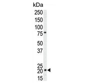 Western blot testing of human T-47D cell lysate with p21WAF1 antibody. Expected molecular weight: 18-21 kDa.