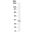 Western blot testing of human testis lysate with COMT antibody at 0.3ug/ml. Predicted molecular weight: ~30/25 kDa (isoforms 1/2).