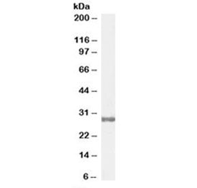 Western blot testing of human testis lysate with COMT antibody at 0.3ug/ml. Predicted molecular weight: ~30/25 kDa (isoforms 1/2).
