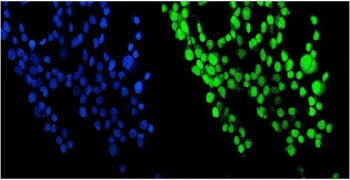 Immunofluorescent staining of FFPE human A431 cells with NUP214 antibody (green) and DAPI nuclear stain (blue). HIER: steam section in pH6 citrate buffer for 20 min.