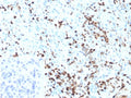 IHC staining of FFPE human spleen tissue with S100A4 antibody (clone S100A4/6801). Inset: PBS used in place of primary Ab (secondary Ab negative control). HIER: boil tissue sections in pH 9 10mM Tris with 1mM EDTA for 20 min and allow to cool before testing.