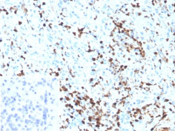 IHC staining of FFPE human spleen tissue with S100A4 antibody (clone S100A4/6801). Inset: PBS used in place of primary Ab (secondary Ab negative control). HIER: boil tissue sections in pH 9 10mM Tris with 1mM EDTA for 20 min and allow to cool before testing.