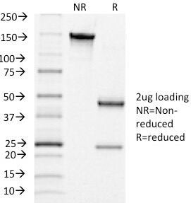 SDS-PAGE Analysis of Purified, BSA-Free hCG Receptor Antibody (clone LHCGR/1415). Confirmation of Integrity and Purity of the Antibody.