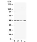 Western blot testing of human 1) SW620, 2) A549, 3) MCF-7 and 4) HeLa cell lysate with MICA antibody. Predicted molecular weight: ~43 kDa but may be observed at 38-62 kDa depending on truncation and glycosylation level.