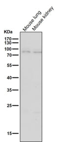 Western blot testing of mouse samples with the BDKRB2 antibody at 1:3000 dilution for 1 hour at room temperature. Predicted molecular weight ~78 kDa.