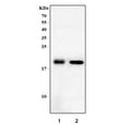 Western blot testing of 1) rat heart and 2) mouse heart tissue lysate with Dtr antibody. Predicted molecular weight ~23 kDa but may be observed at higher molecular weights due to glycosylation.