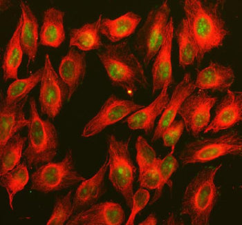 Immunofluorescent staining of BOP1 using anti-BOP1 antibody (green) and anti-Beta Tubulin antibody (red). BOP1 was detected in an immunocytochemical section of U2OS cells. Enzyme antigen retrieval was performed using IHC enzyme antigen retrieval reagent for 15 mins. The cells were blocked with 10% goat serum. And then incubated with 5 ug/ml rabbit anti-BOP1 antibody and mouse anti-Beta Tubulin antibody overnight at 4oC.