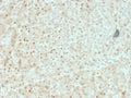 IHC testing of FFPE human pancreas with AKT1 antibody (clone AKT1/2552). HIER: boil tissue sections in pH6, 10mM citrate buffer, for 10-20 min followed by cooling at RT for 20 min.
