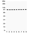Western blot testing of GR antibody and Lane 1: rat liver; 2: (r) brain; 3: (r) spleen; 4: human placenta; 5: (h) SMMC; 6: mouse HEPA; 7: (m) Neuro-2a; 8: (h) HeLa; 9: (r) PC12; Predicted/Observed size: 91~94KD