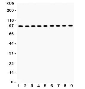 Western blot testing of GR antibody and Lane 1: rat liver; 2: (r) brain; 3: (r) spleen; 4: human placenta; 5: (h) SMMC; 6: mouse HEPA; 7: (m) Neuro-2a; 8: (h) HeLa; 9: (r) PC12; Predicted/Observed size: 91~94KD