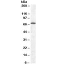 Western blot testing of rat brain lysate with Cannabinoid Receptor antibody at 0.1ug/ml. Predicted molecular weight ~53 kDa, can also be observed at ~70kDa.
