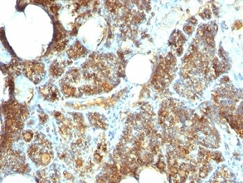 IHC: Formalin-fixed, paraffin-embedded human parathyroid stained with Parathyroid Hormone antibody (clone PTH/1173).