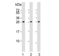 Western blot testing of human 1) A431, 2) skeletal muscle and 3) brain lysate with Density Regulated Protein antibody. Expected molecular weight ~22 kDa (unmodified), 27-31 kDa (modified).