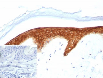 IHC staining of FFPE human skin tissue with SERPINB5 antibody (clone SERPINB5/4974). Inset: PBS used in place of primary Ab (secondary Ab negative control). HIER: boil tissue sections in pH 9 10mM Tris with 1mM EDTA for 20 min and allow to cool before testing.