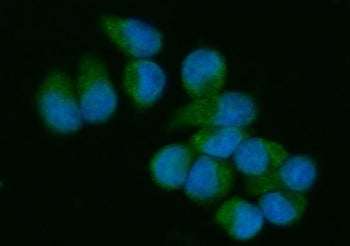 Immunofluorescent staining of FFPE human T-47 D cells with VAV3 antibody (green) and DAPI nuclear stain (blue). HIER: steam section in pH6 citrate buffer for 20 min.
