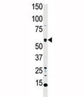 Western blot analysis of MST1 antibody and HL-60 cell lysate. Predicted molecular weight ~ 56 kDa.