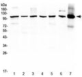 Western blot testing of 1) rat brain, 2) rat lung, 3) rat testis, 4) mouse lung, 5) mouse brain, 6) mouse testis and 7) human HepG2 lysate with HDAC4 antibody at 0.5ug/ml. Expected molecular weight: ~140 kDa (full length), ~95 kDa (truncated).