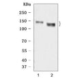 Western blot testing of human 1) A431 and 2) HACAT cell lysate with Desmoglein 3 antibody. Predicted molecular weight: 107 kDa but may be observed at higher molecular weights due to glycosylation.