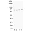 Western blot testing of NOX5 antibody and Lane 1: 22RV1; 2: PANC; 3: HeLa; 4: SKOV. Expected/observed molecular weight: ~86 kDa.