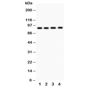 Western blot testing of NOX5 antibody and Lane 1: 22RV1; 2: PANC; 3: HeLa; 4: SKOV. Expected/observed molecular weight: ~86 kDa.