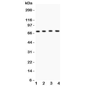 Western blot testing of Kv4.1 antibody and Lane 1: mouse brain; 2: human HeLa; 3: (h) COLO320; 4: (h) A549 lysate. Predicted molecular weight: ~71 kDa.