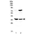 Western blot testing of rat 1) spleen and 2) thymus tissue with CD23 antibody at 0.5ug/ml. Expected molecular weight: 37-45 kDa.