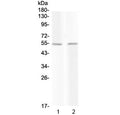 Western blot testing of 1) rat liver and 2) mouse liver with PROC antibody at 0.5ug/ml. Predicted molecular weight ~52 kDa.