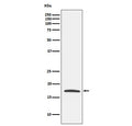 Western blot testing with Claudin 4 antibody. Predicted molecular weight ~22 kDa.