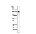 Western blot testing of human A431 cell lysate with recombinant EGF Receptor antibody. Expected molecular weight: 134-180 kDa depending on glycosylation level.