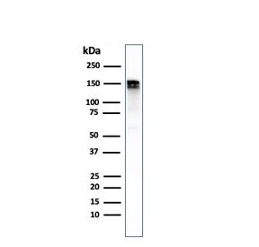 Western blot testing of human A431 cell lysate with recombinant EGF Receptor antibody. Expected molecular weight: 134-180 kDa depending on glycosylation level.