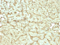 IHC staining of FFPE human liver tissue with recombinant Albumin antibody (clone rALB/6412). HIER: boil tissue sections in pH 9 10mM Tris with 1mM EDTA for 20 min and allow to cool before testing.