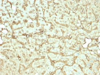 IHC staining of FFPE human liver tissue with recombinant Albumin antibody (clone rALB/6412). HIER: boil tissue sections in pH 9 10mM Tris with 1mM EDTA for 20 min and allow to cool before testing.