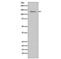 Western blot testing of human T-47D cell lysate with Progesterone Receptor antibody. Expected molecular weight: 82-94 kDa (PR-A) and 99-120 kDa (PR-B).