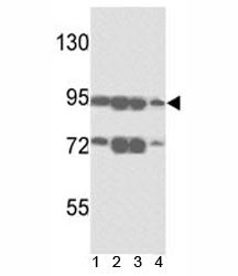 Western blot analysis of ABCB5 antibody and 1) A375, 2) K562, 3) A2058 and4) HL-60 lysate. Predicted molecular weight ~90kDa.