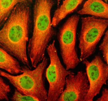 Immunofluorescent staining of TFEC using anti-TFEC antibody (green) and anti-Beta Tubulin antibody (red). TFEC was detected in an immunocytochemical section of U2OS cells. Enzyme antigen retrieval was performed using IHC enzyme antigen retrieval reagent for 15 mins. The cells were blocked with 10% goat serum. And then incubated with 5 ug/ml rabbit anti-TFEC antibody and mouse anti-Beta Tubulin antibody overnight at 4oC.