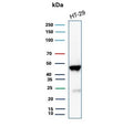 Western blot testing of human HT29 cell lysate with recombinant Cytokeratin 20 antibody. Predicted molecular weight ~46 kDa.
