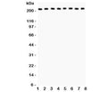 Western blot testing of Integrin alpha 5 antibody and Lane 1: rat brain; 2: mouse brain; 3: human MM231; 4: (h) HeLa; 5: (h) Jurkat; 6: (h) 293T; 7: (m) Neuro-2a; 8: (r) PC12 lysate; Expected molecular weight: 115-160 kDa, observed here at ~220 kDa.