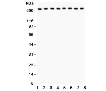Western blot testing of Integrin alpha 5 antibody and Lane 1: rat brain; 2: mouse brain; 3: human MM231; 4: (h) HeLa; 5: (h) Jurkat; 6: (h) 293T; 7: (m) Neuro-2a; 8: (r) PC12 lysate; Expected molecular weight: 115-160 kDa, observed here at ~220 kDa.
