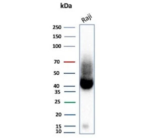 Western blot testing of human Raji tissue lysate with ADPRC1 antibody (clone CD38/9333). Expected molecular weight: 34-46 kDa depending on glycosylation level.