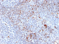 IHC staining of FFPE human tonsil tissue with SATB1 antibody (clone SATB1/2661). HIER: boil tissue sections in pH 9 10mM Tris with 1mM EDTA for 20 min and allow to cool before testing.