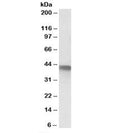 Western blot testing of A549 lysate with SERPINB1 antibody at 1ug/ml. Predicted/observed molecular weight: ~43kDa.