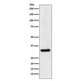 Western blot testing of human HepG2 cell lysate with HNRNPA1 antibody. Expected molecular weight: ~34 and/or 39 kDa.