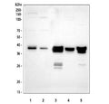 Western blot testing of 1) human HepG2, 2) human HeLa, 3) rat liver, 4) rat RH35 and 5) mouse liver tissue lysate with ADH4 antibody at 0.5ug/ml. Predicted molecular weight ~40 kDa.